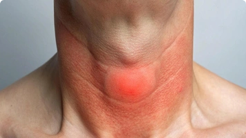 Man clutching abdomen near a toilet, suggesting digestive issues.