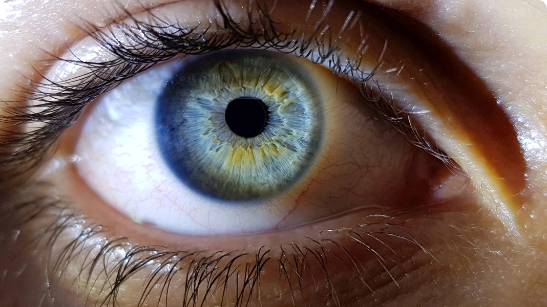 Close-up of a wide-open eye with visible blood vessels.