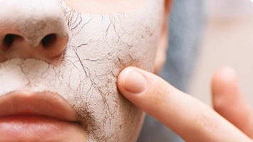 Brittle or ridged fingernails