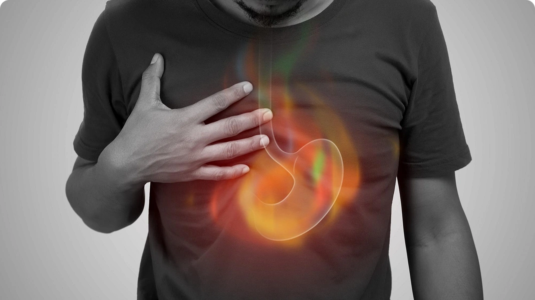 Woman with acid reflux or heartburn pain.